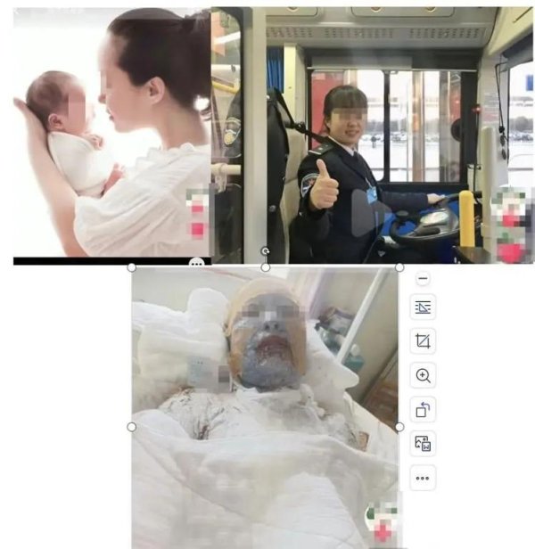 金信达 妻子遇液化气泄漏爆炸全身超九成烧伤，丈夫全网求助：“不敢想象她该有多疼”